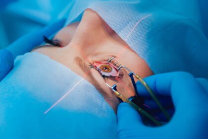 Who is a good candidate for PRK surgery?