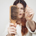Reasons For Hair Loss and Its Treatment