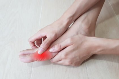 Painful Bunions
