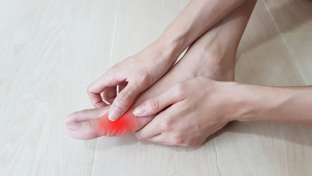 6 Best Tips for Treating Painful Bunions