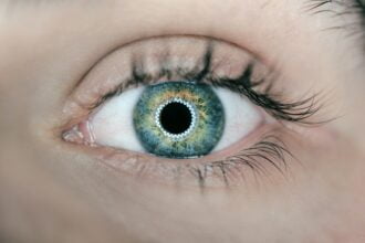 LASIK Eye Surgery