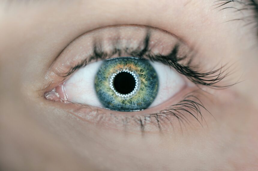 LASIK Eye Surgery