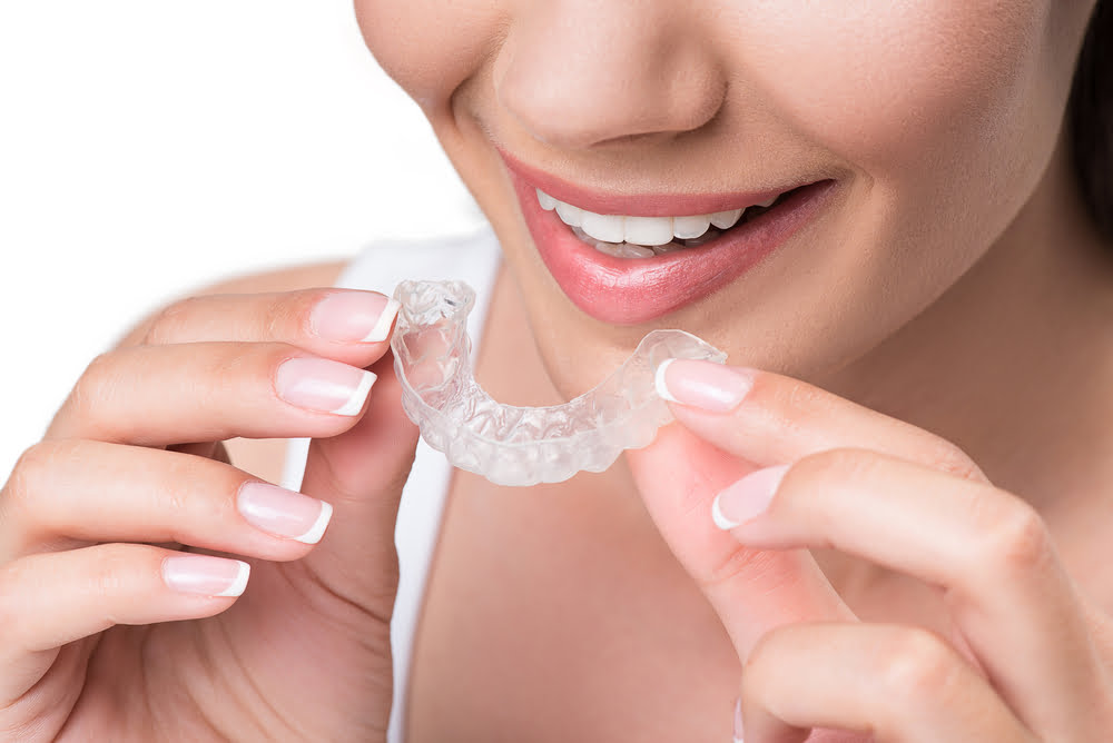benefits of clear aligners for orthodontists