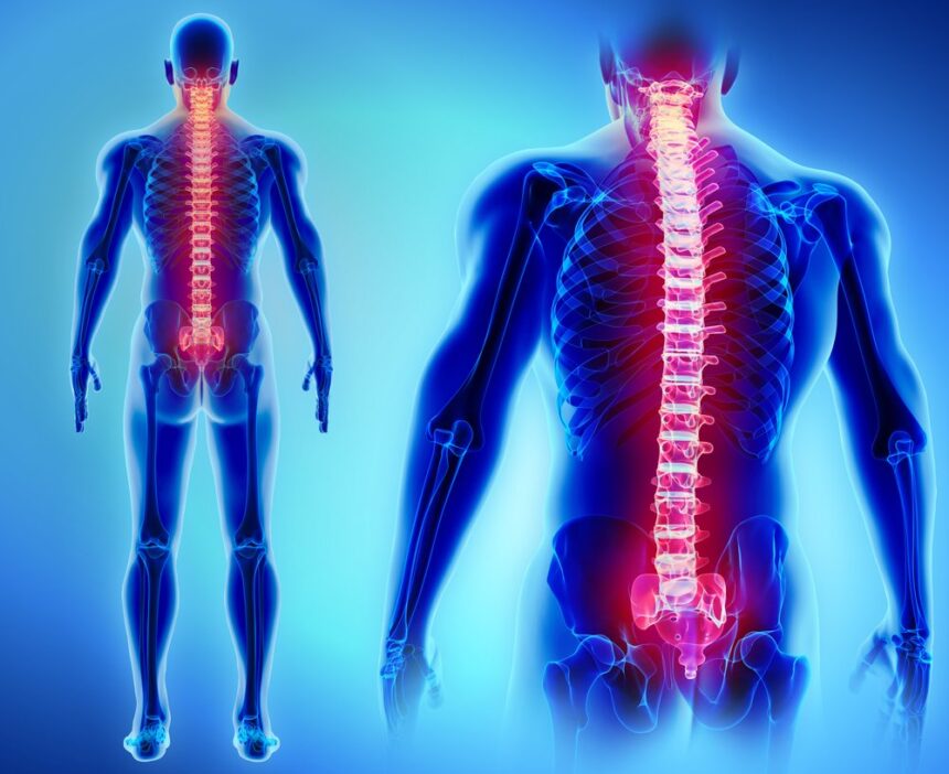 understand costs of spinal injuries to get the right compensation