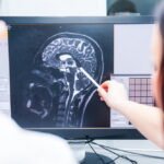 How Can Brain Injury Lead To Dangerous Long-Term Effects?