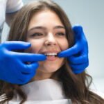 dental veneers benefits