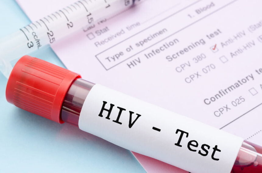 benefits of taking HIV tests at home