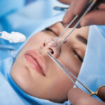 Rhinoplasty surgery for well-being