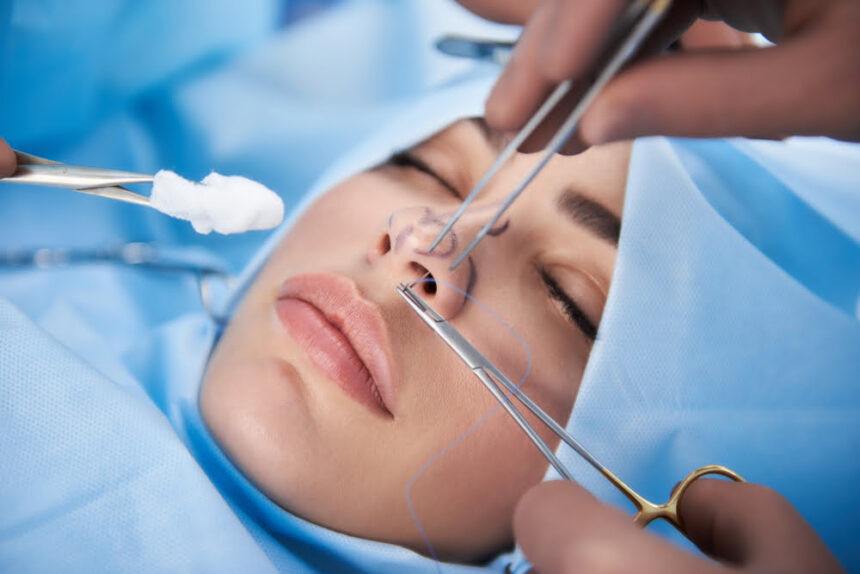 Rhinoplasty surgery for well-being