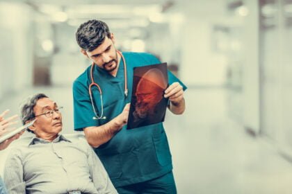 common misconseptions about brain injuries