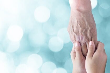 eligble for NDIS?