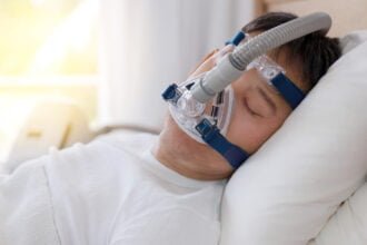 sleep apnea