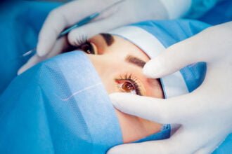 laser eye surgery