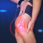 knee injury compensation