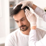 men hair loss problem with health