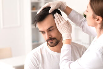men hair loss problem with health