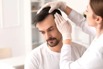 men hair loss problem with health