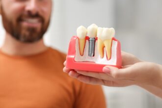 dental prosthetics