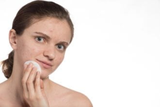 stop acne