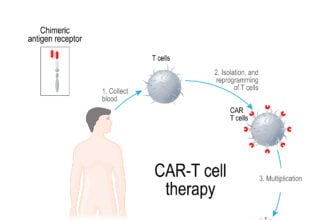 CAR-T-cell Therapy