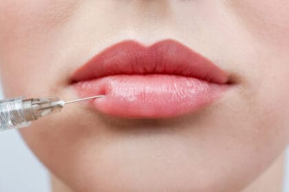lip fillers and mental health