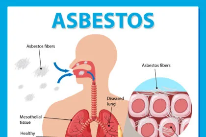 Understanding the Connection Between Asbestos and Mesothelioma