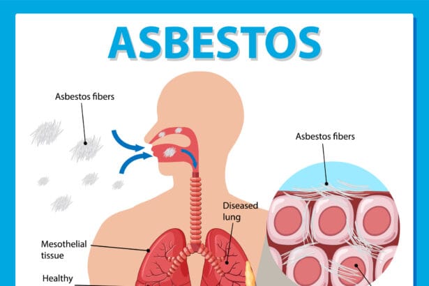 Understanding the Connection Between Asbestos and Mesothelioma