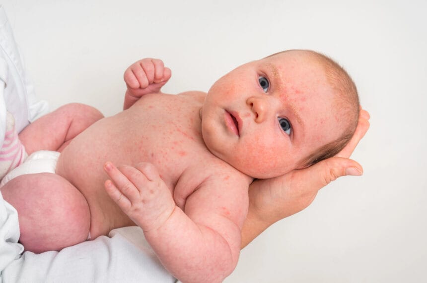 Why Legal Help Is Crucial for Families Affected by Birth Injuries