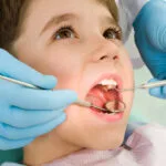 Modern Teeth Whitening Technologies Used by Clinics in Ireland