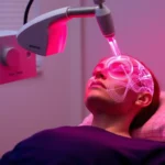 Transcranial Magnetic Stimulation (TMS) Therapy
