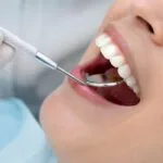 close up of dental examination in belo horizonte clinic