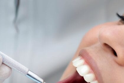 close up of dental examination in belo horizonte clinic